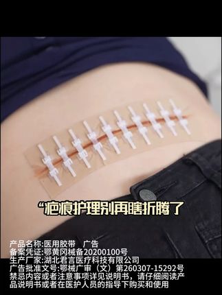 #剖腹产 产后疤痕护理床别再瞎折腾了,快使用这款医用减张器~#剖腹产疤痕 #疤痕护理 #减张器怎么用 #减张器