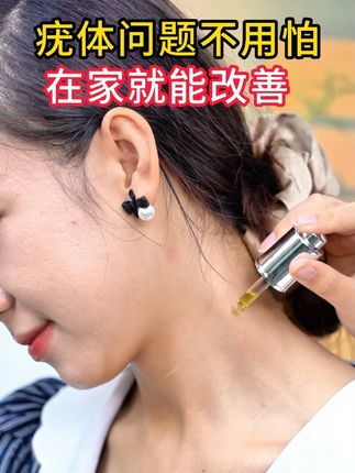 脖子上这种小肉丝,会传染,一定要警惕,教你一招处理! #hpv 脖子上这种小肉丝,会传染,一定要警惕,教你一招处理!#疣#丝状疣#丝状疣祛除#脖子上的小肉粒