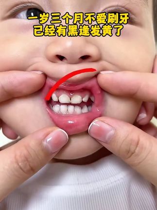 不要等到宝宝牙齿不舒服了才着急,要提早注意口腔环境,宝宝爱吃甜食夜奶不爱刷牙,抗拒刷牙就可以备上这个#儿童口腔喷雾 #宝宝护理 #母婴好物 #好产品一起分享 #好物推荐🔥