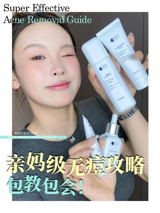 啥?私人订制的风都吹到祛痘界了? #女生必看 #IRY #痘肌 #祛痘 #祛痘攻略