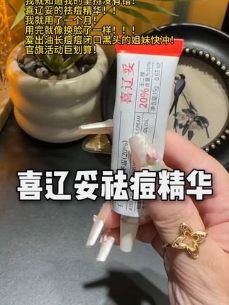 再也不用走祛痘的弯路了!!!姐妹们快冲!!!#喜辽妥#壬二酸#祛痘精华#油痘肌#超划算