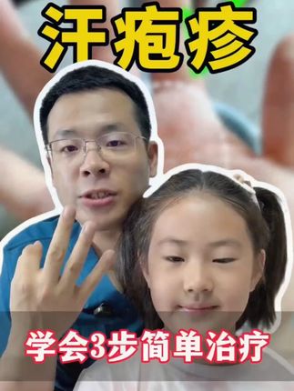 #汗疱疹膏推荐 汗 #手脚护理 #反复脱皮 #居家常备 #清爽一夏