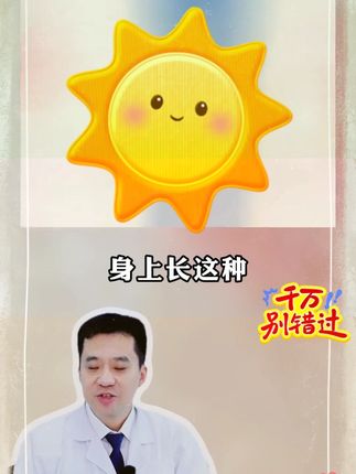 #卡泊三醇倍他米松软膏  #卡泊三醇  #国货之光  #医学科普  #牛皮藓