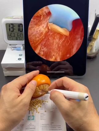 #可视掏耳勺  #采耳神器  #解压工具