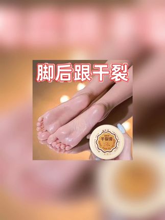 脚后跟得嫩嫩的才好看,用这个坚持涂,穿凉鞋美美哒,现在涂还来得及#皴裂膏