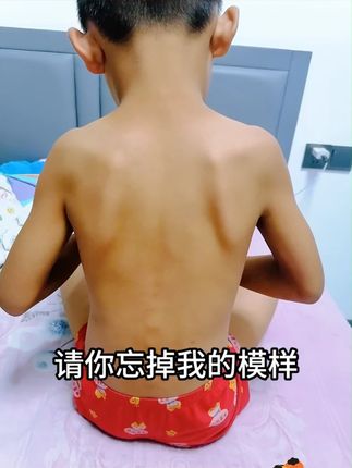 请你忘掉我的模样 如果你家小孩都没有高速成长的经历,那家长真要好好反省一下。#小葵花 #氨基丁酸 #成长