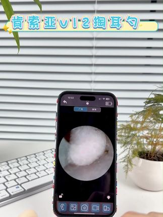 可视掏耳勺到底是智商税吗?一个视频给你讲解清楚。 传统掏耳勺:盲掏!生怕捅破了! 普通可视掏耳勺:只能看,掏不出来干着急! 这个神器:边看边掏,精准打击!百发百中! 适用人群: 追求极致解压的“挖矿”爱好者 担心给孩子掏耳不安全的宝妈宝爸 耳朵容易痒、有油耳困扰的家人 效果堪比影院级大片! 自己掏、给对象掏、给宝宝掏,全家都能用!评论区置顶搜索链接 #肯索亚可视掏耳勺 #可视掏耳勺 #可视挖耳勺 #采耳工具 #掏耳朵神器