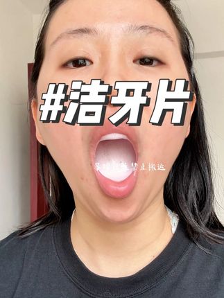 主包同款 #missicey益生菌洁牙片 #missicey洁牙片测评 #洁牙片