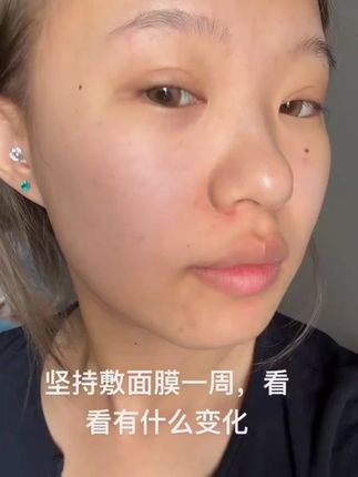 如果你也是熬夜后,皮肤干燥 粗糙暗沉松垮的,快试试这款#美白面膜 #面膜 #面膜面膜敷起来 #提亮肤色改善暗沉