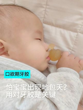 怕宝宝出现地包天?便宜好用的兔子牙胶来了 #记录宝宝#长牙期的宝宝#这是啥呀这么好吃#宝宝爱吃#牙胶