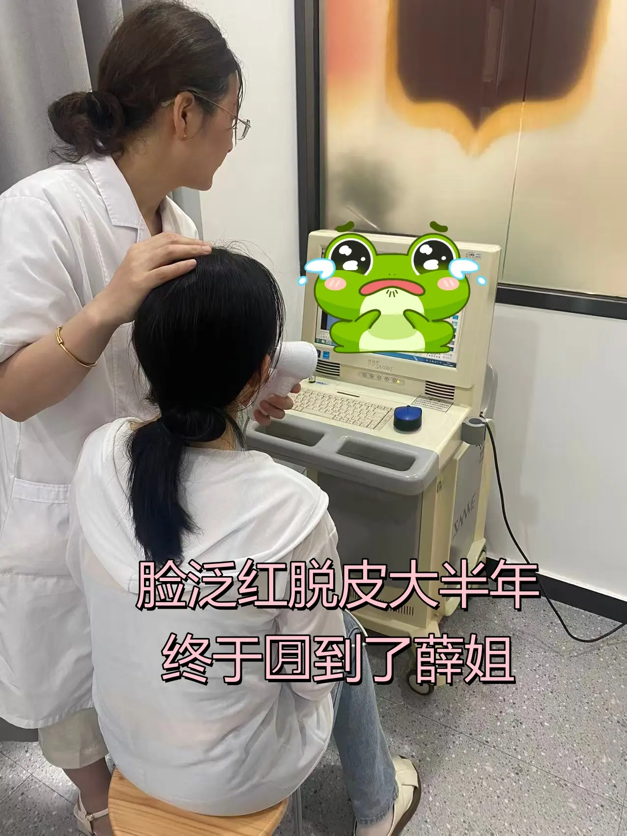 脸泛红脱皮大半年,涂什么都刺痛,化妆都盖不住红。身边人推荐温 - 抖音