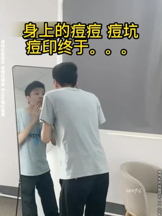 想要一个干净的后背真的不难! 前胸后背痘用它!#身体抛光水#祛痘#夏天必备