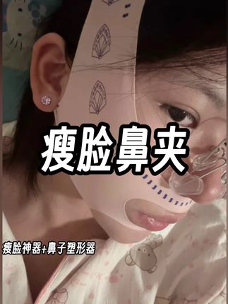 瘦脸鼻夹 瘦脸神器v脸绷带 鼻夹 瘦脸鼻夹塑形器 瘦脸鼻夹 鼻夹子塑形器 痩脸神器v脸绷带 夹鼻器 瘦脸神器v脸绷带真实测评 鼻夹 瘦脸绷带 夹鼻子 脸部提拉绷带 鼻夹子塑形器测评 鼻翼缩小神器 鼻子塑形器 脸部提拉 塑形鼻夹 瘦脸绷带效果 夹鼻子神器高鼻梁 瘦脸鼻夹 鼻夹瘦鼻 瘦脸神器#瘦脸鼻夹 #瘦脸鼻夹瘦脸