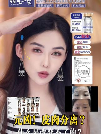 什么是皮肉分离的元凶?! #媛气少女YONQIGIRL #媛气少女童颜PLLA #媛气少女胶原蛋白 #媛气少女居家水光 #三型胶原蛋白