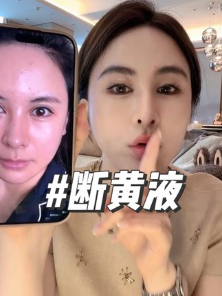 皮肤黄对女人的气质影响很大,小心甘亲测七天断黄液 #小心甘 #断黄液 #护肤 #美白 #去黄