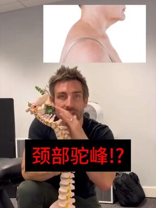 用这个修复颈部驼峰和姿势#驼峰#颈部放松