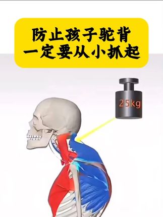 防止孩子驼背,妈妈一定要从小抓起 #宝妈推荐 #培养孩子好习惯 #坐姿
