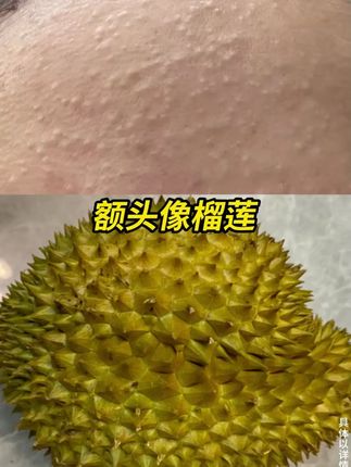 究竟是多好用的洗面奶,多位明星达人都被种草了!净痘洁面#薇诺娜 #净痘 #祛痘控油 #补水舒缓