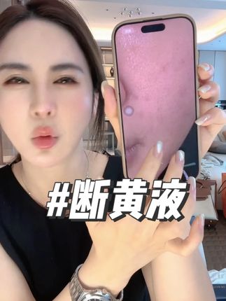 女人去黄真的很重要,小心甘亲测的产品断黄液好好用 #小心甘 #断黄液 #护肤 #美白 #去黄