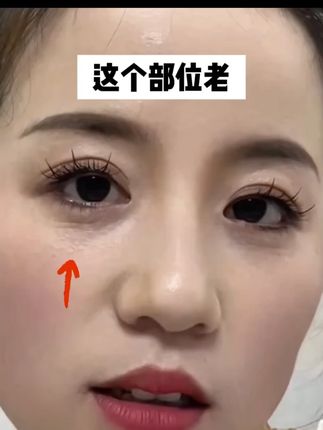 不要让满脸皱纹暴露了你的年龄,试试这个维生素C眼部抗皱精华油#法令纹 #鱼尾纹 #细纹 #精华油 #抗皱
