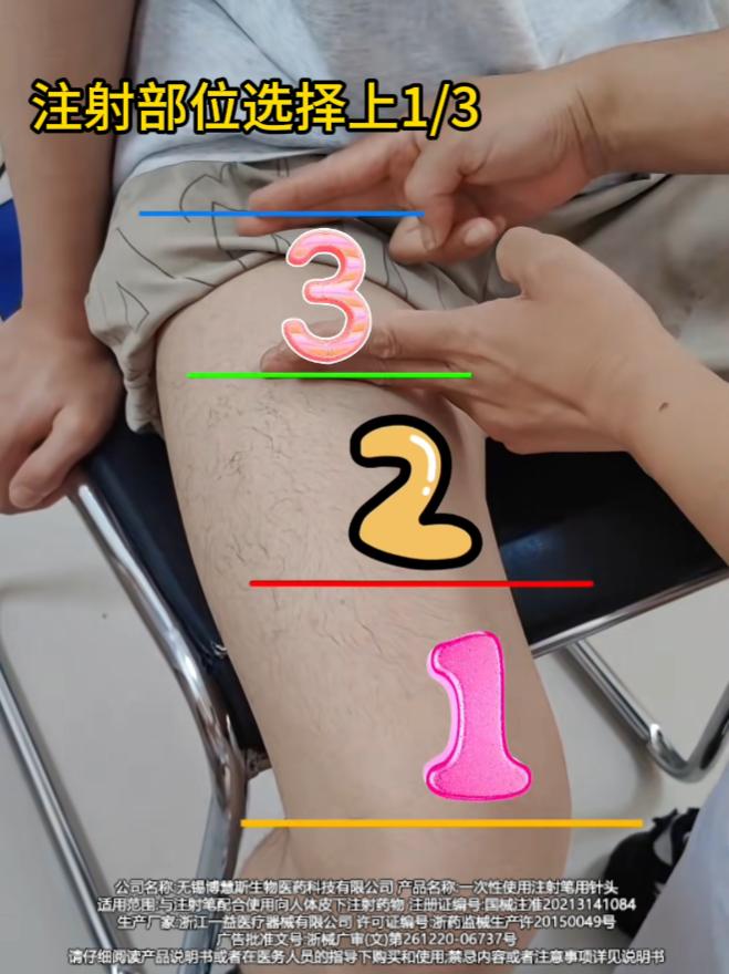 大腿胰岛素注射部位。选择大腿内侧上1/3位置#胰岛素针头#糖尿病#糖友#一型糖尿病
