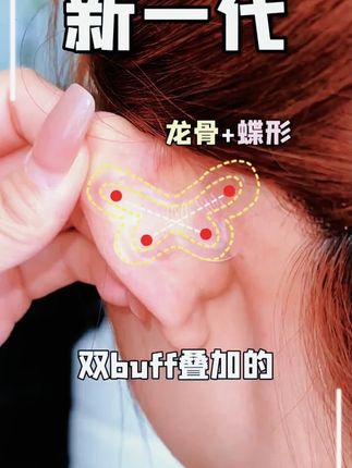 显脸小的变美小心机!贴上脸直接小了一圈,关键贴着还不疼!#仙女必备 #显脸小 #耳贴 #超便宜超划算