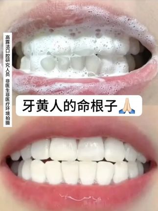 被牙齿困扰的小宝们有福了!!! #热点 #牙膏 #孙颖莎 #好物推荐🔥 #美白