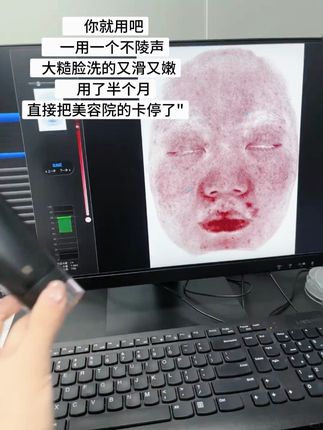 一定要坚持洗!连续洗!长期洗!现在素颜状态超抗打#雪玲妃洗面奶