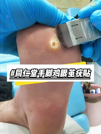#好物推荐🔥 #手足护理 #宝藏好物 #视频同款