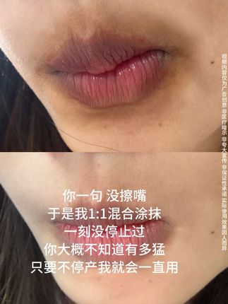 对付暗沉真的很牛,用了一个月真的后悔没有早点用!#嘴角 #唇周 #好物推荐🔥 #全身 #好物分享🔥