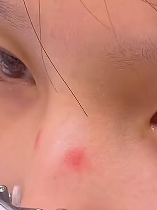 防滑鼻托,防压 #鼻托