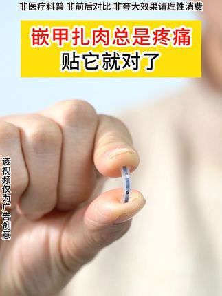 反复嵌甲就用它,钛合金硅胶正甲贴 zrl#甲沟炎#嵌甲#脚趾甲往肉里长怎么办#平价好物