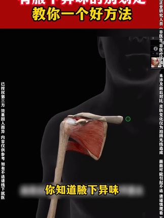 三年以上请注意:体味难闻,腋下爱出汗,腋下异味怎么办?#鑫正堂 #四氯羟铝锆