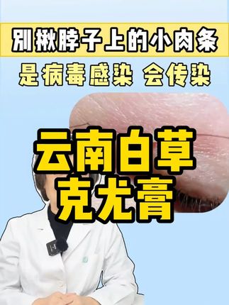 坚持涂它几天,看看你的有什么变化!其实改善很简单#脖子上的小肉粒 #怎么袪除疣 #扁平疣 #肉刺瘊子肉粒怎么袪除 #趾疣
