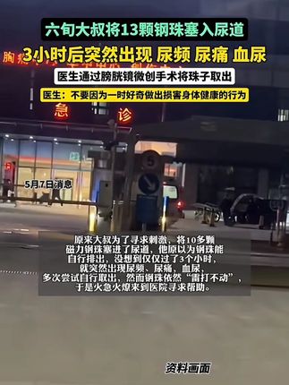 #烤肉夹子  #厨房必备  #烧烤夹子  #高级感  #韩式烤肉