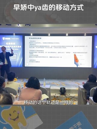 牙齿移动的方式都有哪几种? #活动矫治器 #牙齿移动 #早期矫治