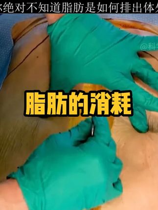 你绝对不知道你身上的脂肪是这样排出体外的#科普