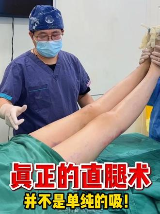 真正的直腿术,并不是单纯的吸! #卢九宁 #直腿术