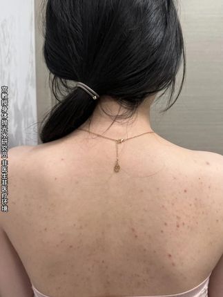 想要一个干净的后背真的不难!前胸后背痘用它!#身体抛光水#祛痘#夏天必备
