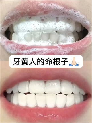 冰泉牙膏 这牙膏也太戳人了!!9命!我的少女心!!#冰泉牙膏 #冰泉 #美白牙膏 #美白牙膏推荐 #自用好物分享
