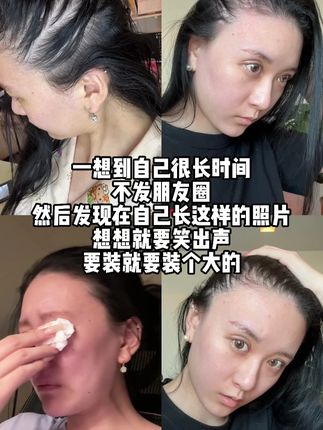 请大数据推荐给有需要的人! #维生素 #维生素B