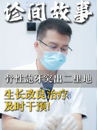 骨性龅牙突出二里地 生长改良及时干预! #早期矫治 #正畸教授徐宝华 #嘴突 #龅牙 #下颌后缩