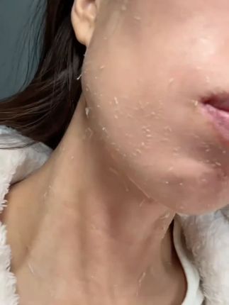 晚上睡觉经常挠背、挠头 身上头上痒的,该除螨了!螨虫超标 用硫磺除螨抑菌液体皂!洗头,洗脸沐浴三合一还祛痘控油
