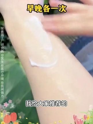 还在为干裂烦恼这款尿素霜维E乳会是你的救星效果惊艳价格亲民 #尿素霜 护手