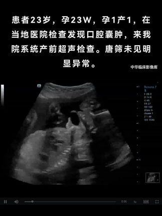 今日案例分享 可诊断出什么? #医学影像 #医学影像学 #ct #人民卫生电子音像出版社 #医学