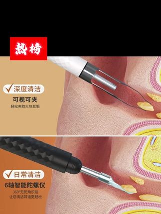 可视掏耳勺镊子挖耳勺掏耳勺耳耵聍掏耳朵神器采耳工具#可视掏耳勺 #可视掏耳勺神器 #可视掏耳勺采耳 #好物推荐🔥 #平价好物