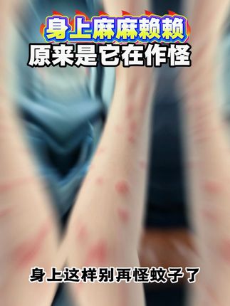 2 #跳蚤如何彻底消灭 #跳蚤 #灭跳蚤方法 #跳蚤药 #汼楯呋虫胺