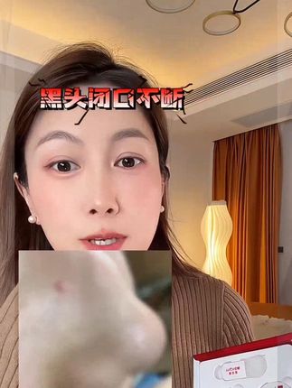 薇诺娜清洁泥膜 清洁不到位,用再贵的护肤品都白费!#薇诺娜# #薇诺娜清洁泥膜# 泥膜温和清洁涂抹面膜