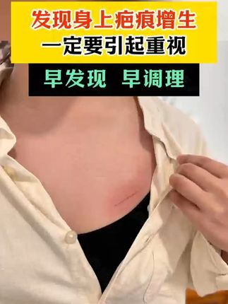 有种折磨叫疤痕,及影响美观,还会有不适感 #淡疤#疤痕#疤痕增生#疤痕体质#淡疤小行家