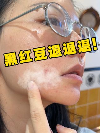 黑红痘印速退!战痘十年总结的保姆级教程!巨简单巨好用!#烂脸 #油痘肌 #黑红痘印 #焕颜有方补光灯精华